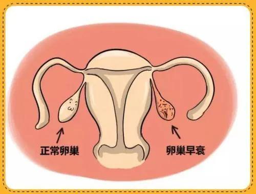 卵巢早衰试管前如何调理？科学调理为生育力“续航”